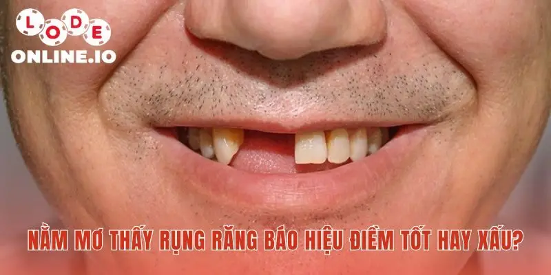 Mơ thấy rụng răng thường cảnh báo những điềm không may mắn